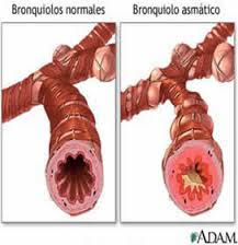 bronquiolo